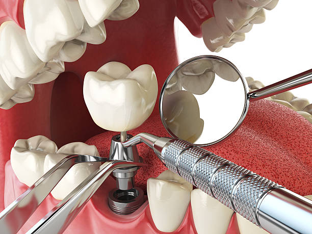 Best Emergency Dental Surgery in Cheverly, MD